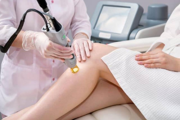 Epilasyon-lazeri-ile-proktoloji